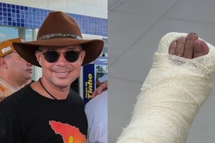 Governador Fábio Mitidieri fratura o pé durante cavalgada em Tobias Barreto