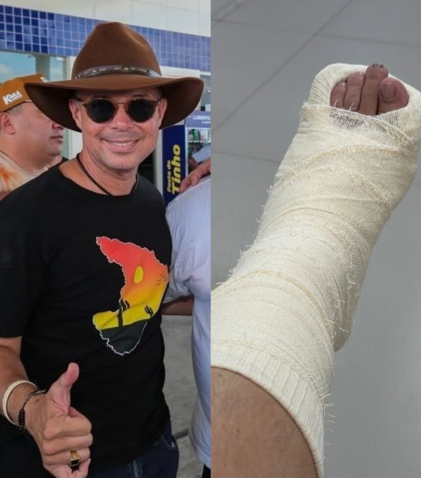 Governador Fábio Mitidieri fratura o pé durante cavalgada em Tobias Barreto