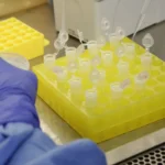 SP confirma segundo caso importado de sarampo