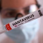 Duas pessoas retiradas de navio testam positivo para o hantavírus