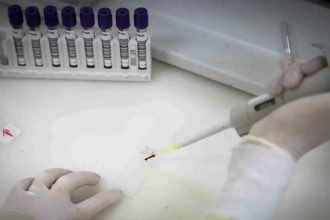 Paciente em SP com suspeita de ebola testa positivo para meningite