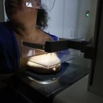 ANS defende que plano cubra mamografia digital sem restrição de idade