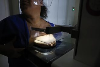 ANS defende que plano cubra mamografia digital sem restrição de idade