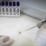 Exames descartam ebola em imigrante da República Democrática do Congo