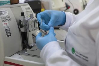 SUS inclui nova terapia para pacientes adultos com leucemia mieloide