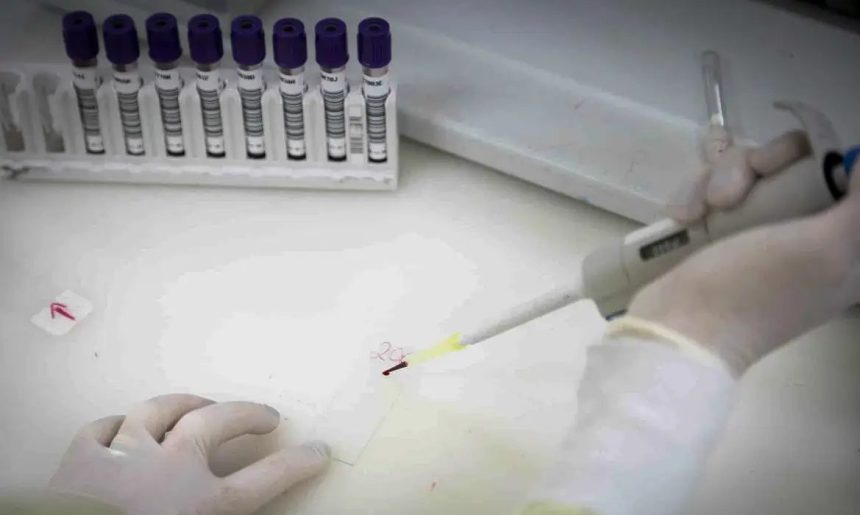 Secretaria de Saúde de SP investiga novo caso suspeito de ebola