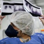Diagnóstico tardio dá poucas chances de cura para o câncer de pulmão