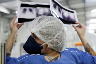 Diagnóstico tardio dá poucas chances de cura para o câncer de pulmão