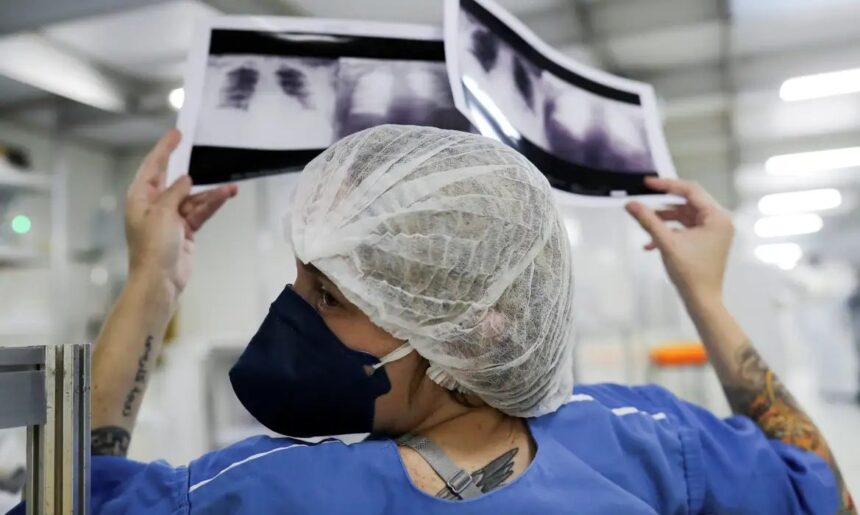 Diagnóstico tardio dá poucas chances de cura para o câncer de pulmão