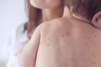 Estado de São Paulo reforça necessidade de vacinação contra o sarampo