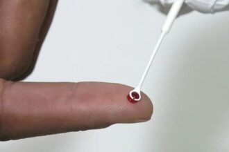 Fiji declara emergência nacional por HIV com 1 caso a cada 60 pessoas