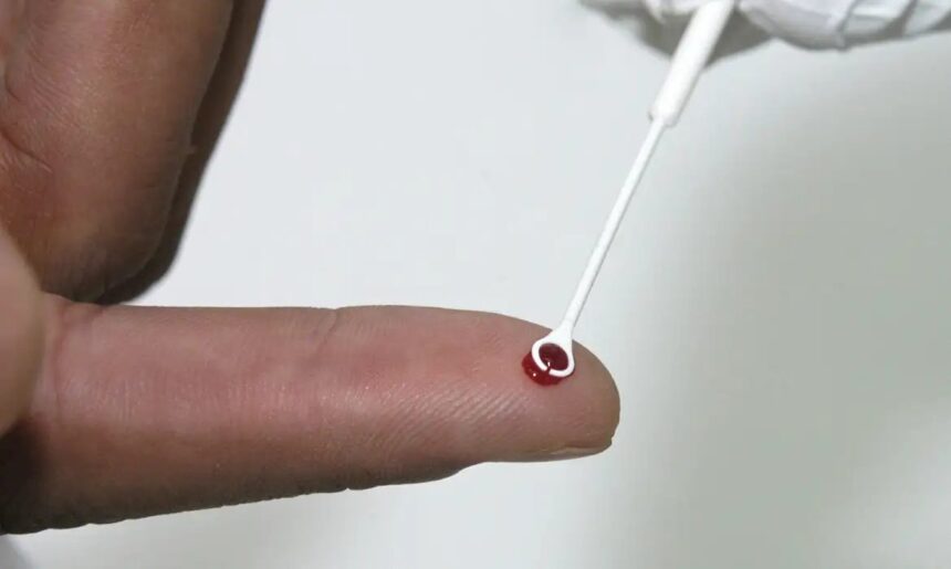 Fiji declara emergência nacional por HIV com 1 caso a cada 60 pessoas